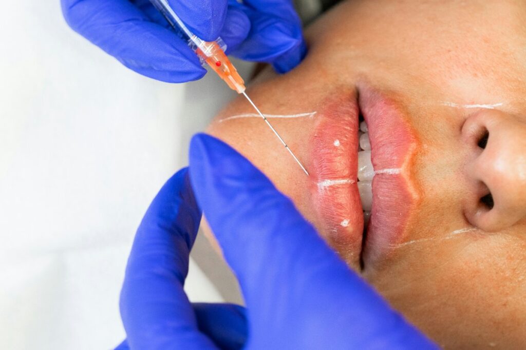 Doctor administering dermal filler injection at Kora Lawler Aesthetics
